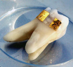 Figure 1  The human tooth.