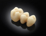 Zahn Dental’s full-contour solution