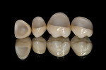 Millenium Concept by One Source Dental