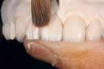 Figure  9  After the center lobe was built in using light and salmon mamelon powders, OE4 (white dentin) powder was used to create the mesial and distal internal lobes.