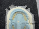 Figure  9  The Duoflask allowed the technician to process two prostheses simultaneously.
