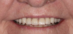 Figure  13 A view of the patient’s smile after.