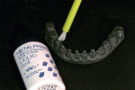 Figure 19  GC Metal Primer IIwas the first application to theimplant bar and was done priorto opaque.