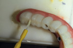 Figure 29  Stain was applied to theinterproximal contact areas tocreate lifelike gradation of color.