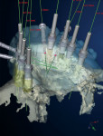 Figure 14  The surgical template was constructed on interactive software (Procera). Fixture size, distribution in the arch, positions relative to the desired tooth positions, and implant angulations were all considered in creating the virtual plan.