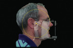 Figure 1  A face-bow articulated, centric relation-mounted set of models provides the dentist with a way to reproduce how the patients’ jaws and dentition function.