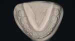 Figure 3c  Stone models reproducing detail from the PVC impressions. Note the occlusal surface and soft tissue detail.