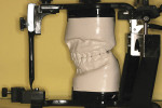 Figure 7c  An accurately mounted set of face-bow articulated centric relation-mounted study models ready for the examination, treatment planning, and restorative phases of treatment (pin removed for viewing).
