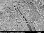 Figure 4  The scanning electron micrograph (SEM) image reveals thatthe cytoplasmic extensions extend at least one third into the dentin, andmay extend the entire length of the tubules, which is why the dentin hasbeen regarded as an anatomical and phy