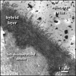 Figure 4  This TEM photomicrograph illustrates the adhesive-dentin interface produced by the HEMA/TEG-DMA-freethree-step etch-and-rinse adhesive system.