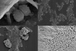 Figure 1  The oral microbial diversity shown by SEM (scanning electron microscopy) is the basis of a growing recognition that each individual’s microbiota is a personal signature (OMS-Oral Microbial Signature) and an indicator of health or dise