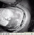 Figure 2  Lava C.O.S. digital impression scan video of a prepared tooth ready for margin-marking exhibiting detail, as viewed on a monitor.