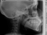 Figure 8  View of a cephalometric radiograph showing the patient's skeletal form