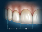 Figure 19  Illustration of the principles of the Golden Proportion. Adapted with permission from the American Academy of Cosmetic Dentistry (www.aacd.com).