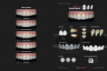 Figure 23  View of the author's smile selection book for use as a doctor/patient communication tool.