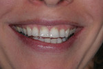 Figure 19 Case 7 pre-treatment photograph of patient’s smile.