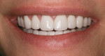 Figure 29 Case 9 post-treatment photograph of patient’s smile.
