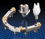 Figure 2 Glidewell Laboratories provides implant CAD/CAM outsourcing services, including design and manufacture of Inclusive® Custom Implant Abutments and Bars.