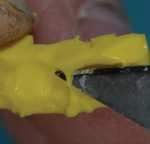 Figure 3 Pit-and-fissure or interproximal areas of bite are trimmed to allow the full seating of bite and cast.