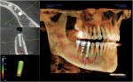 Figure 2   i-CAT x-ray options: Traditional 2-D pan.