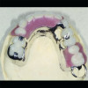 (6.) Orthodontic dental arch and airway expansion. Images courtesy of Mark Farina, DMD.