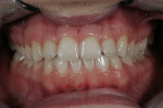 Figure  1  Initial intraoral view.