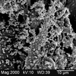 Figure 6  Typical SEM of a denture depth. Note multiple forms of bacteria that comprise the biofilm (original magnification = 2,000X).