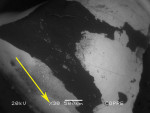 Figure 5  BSE-SEM image showing a pigmented area on the primary canine.
