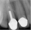 Figure 2. Dental Probes