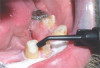 Fig 7. Existing dentition was sound periodontally and reasonably esthetic.