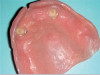 Fig 1. Facial frontal view with smile before treatment.