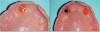 Fig 3. Facial frontal view before treatment.