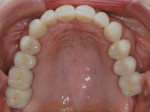 Figure 22  Final postoperative photographs demonstrate successful esthetic results.