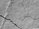 Figure 2  Evidence of biofilm removal with SEM after 3 seconds of use with water flosser on medium pressure. (Fig 2) After use at 20 µm. Note the almost complete removal of biofilm from the tooth surface.