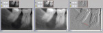 Figure 2 This panel shows an overexposed image on the left and the same image in the center after post-processing to improve contrast. The image on the right demonstrates the 