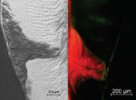Figure 2 (A) Scanning electron microscopic image of a resininfiltrated interproximal enamel carious lesion. (B) Confocal microscopic image of an infiltrated interproximal caries lesion. The infiltrant is displayed red, porosities are green.