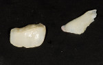 Figure 3 Tooth fragments.