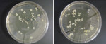 Figure 1 Representative images of nutrient agar plates with bacterial isolates grown from clips sampled following dental treatment.