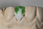 Figure 11 - Inside dentin colors.