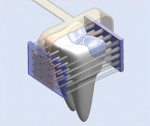 Figure 1 S-Ray technology places ultrsound sending and receiving units on either side of the teeth.