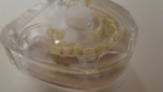 Figure 10 Dentin Shade A1 injected and light-cured.