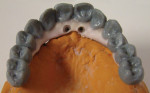 Figure 8 Wax-up of dentition, occlusal view.