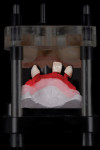 Figure 7 The denture teeth are released from the matrix after transferring resin onto the frame base.