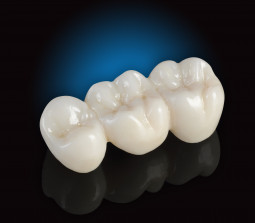 BioZX2 by Dental Arts Laboratories, Inc.