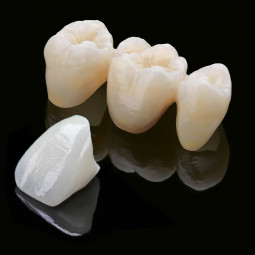 Zirlux™ Universal Zirconia System by Zahn Dental