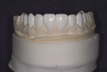 Figure 10. Final wax-up showing ideal proportions and proposed shapes of anterior
teeth.
