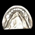Figure 2 Digital volume of the mandibular cast after optical scanning.
