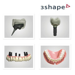 Dental System™ 2013 by 3Shape Inc.