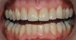 Figure 15  Anterior teeth have been restored to create proportionate balance and harmony.