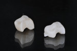 Figure 1 Restorations milled from Lava Ultimate Restorative, which requires no final firing.